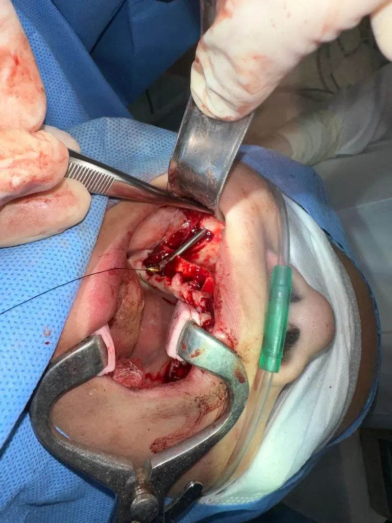 WhatsApp Image 2025-07-17 at 21.31.14.webp