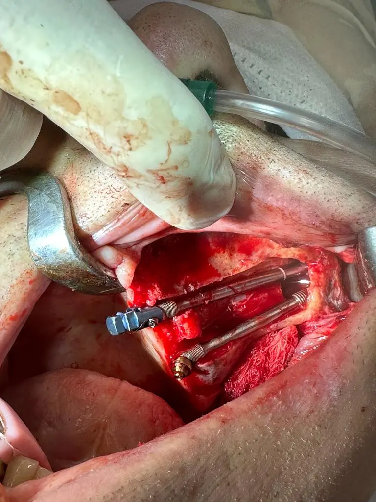 WhatsApp Image 2025-07-17 at 21.31.13 (2).webp